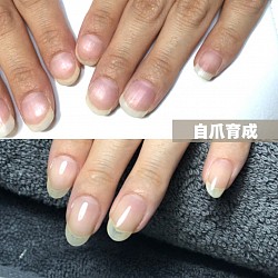 自爪育成