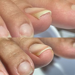アクリルケア
